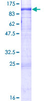 12.5% SDS-PAGE Stained with Coomassie Blue.